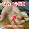 ばね指治療の実践編をマスター・指の開閉時の ひっかかりを無くす治療法を考える / メルマガ